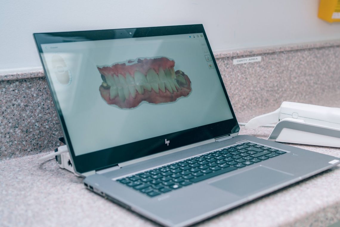 3d scan 2