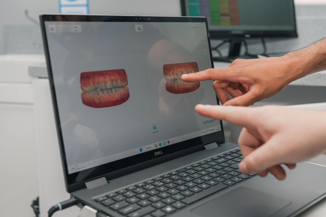 3D scan 1