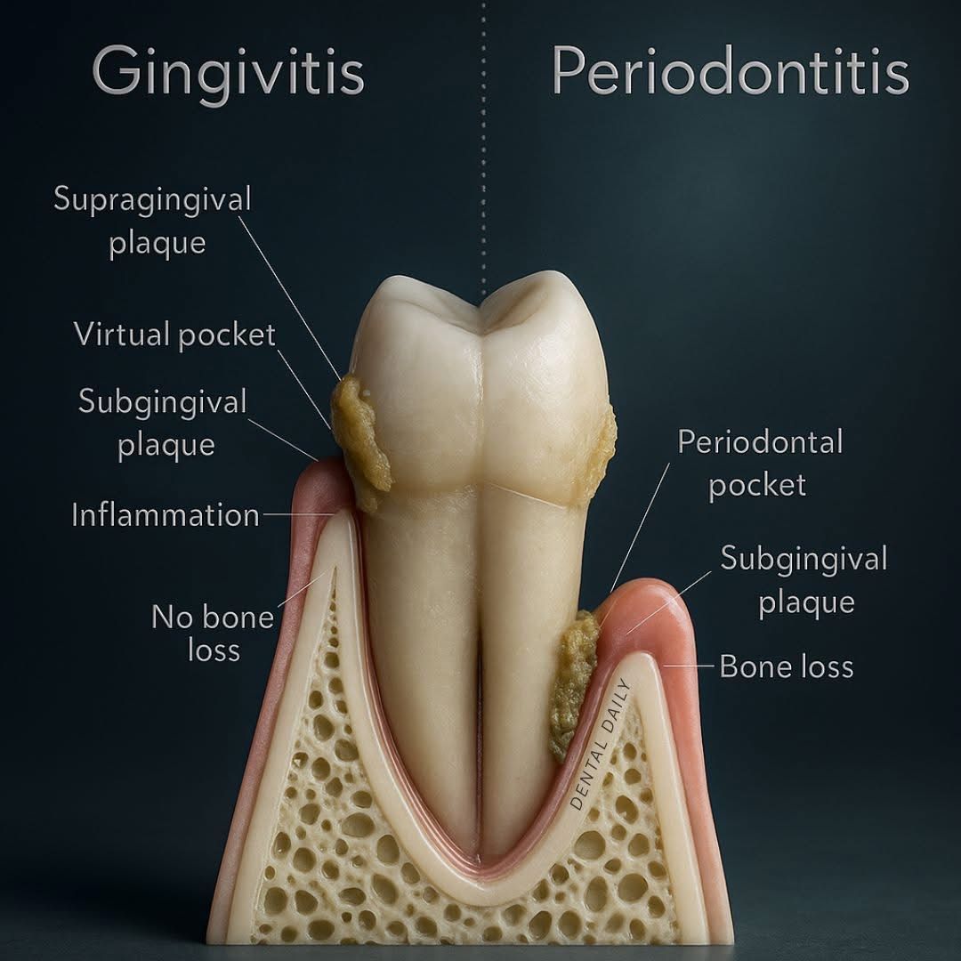 Periodontal visual aid