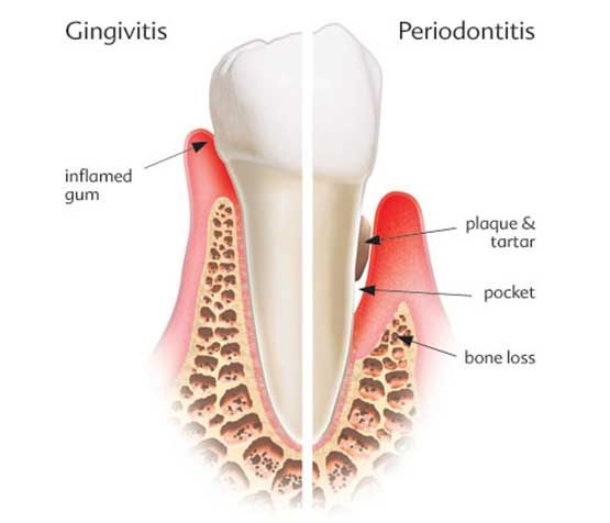 Periodontics at Lynn Road